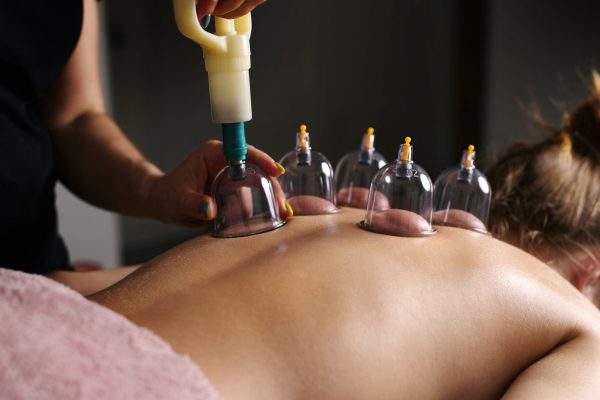 Procedures With The Vacuum Cups In A Massage Spa Salon